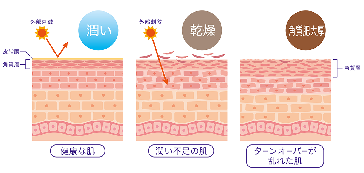 健康な肌とターンオーバーが乱れた肌